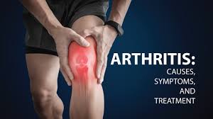 Causes and symptoms of Arthritis