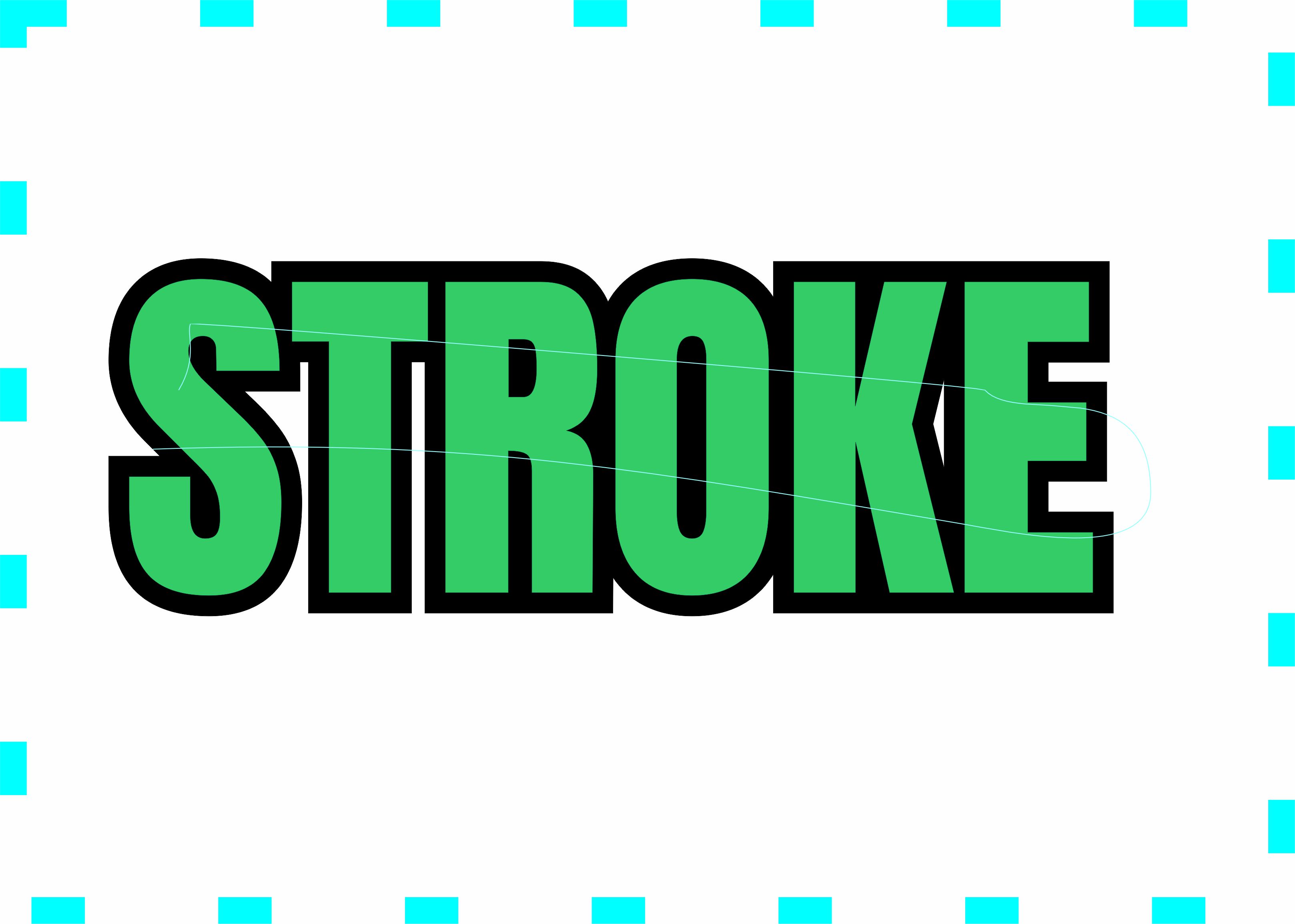 Stroke: Understanding the Causes, Recognizing the Symptoms, and Prioritizing Brain Health.